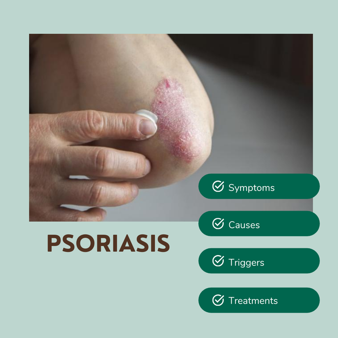 Is Psoriasis Contagious and hereditary? (+ Other FAQs)