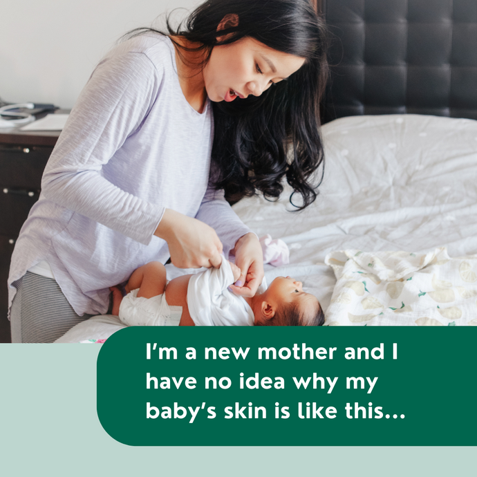 The 101 Guide to Common Baby's Skin Problems